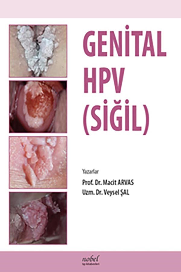 Genital HPV (SİĞİL)