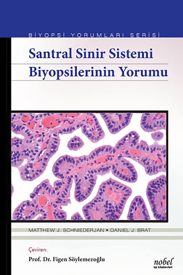 Santral Sinir Sistemi Biyopsilerinin Yorumu - Biyopsi Yorumları Serisi