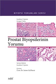 Prostat Biyopsilerinin Yorumu - Biyopsi Yorumları Serisi